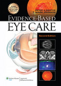Evidence-based eye care